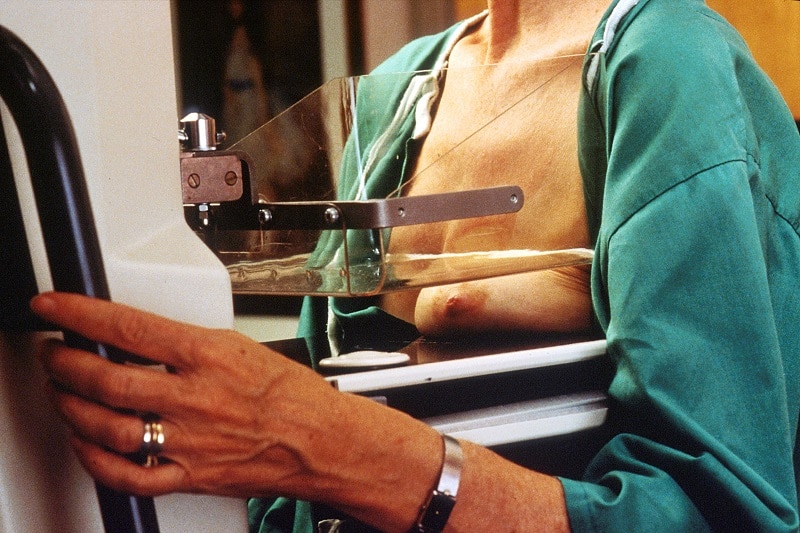 El cáncer de mama se puede detectar tempranamente mediante la mamografía