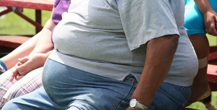 El hígado graso en numerosas ocasiones se asocia a obesidad 