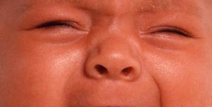 Se considera que los colicos se caracterizan por presentar un llanto incontrolable en un bebé sano. 