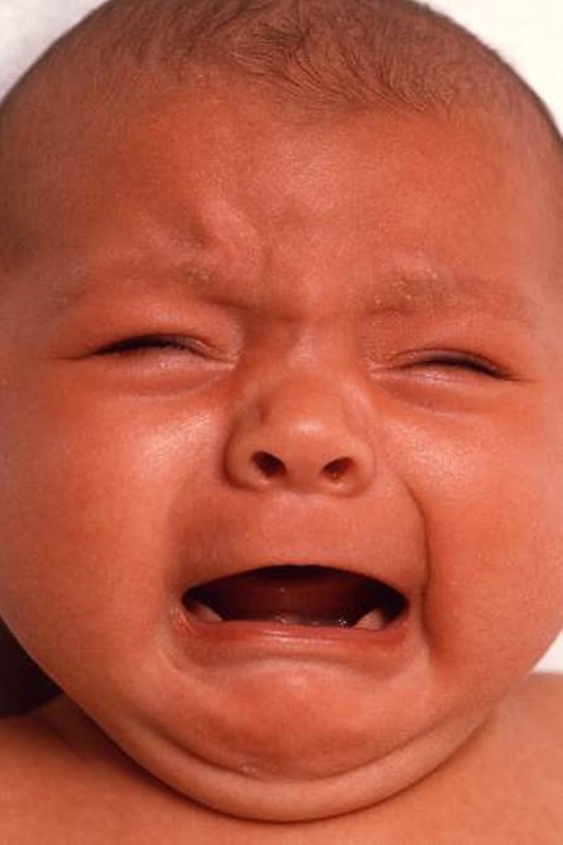 Se considera que los colicos se caracterizan por presentar un llanto incontrolable en un bebé sano.