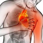 Se pueden prevenir el 90% de los infartos del corazon