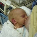 Bilirrubina alta neonatal
