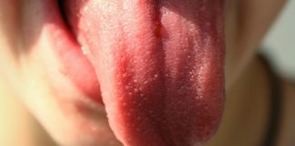 lengua rosada y limpia lengua blanca y pastosa cáncer de lengua