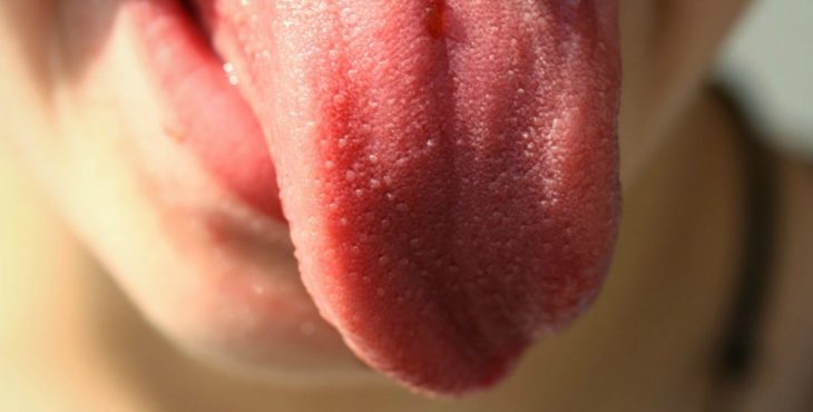 lengua rosada y limpia lengua blanca y pastosa