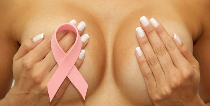 Sintomas del cancer de mama