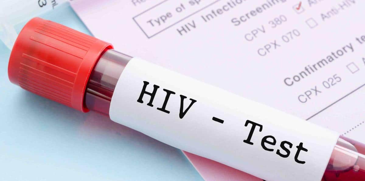 Síntomas del SIDA y del VIH, aprende a reconocerlos