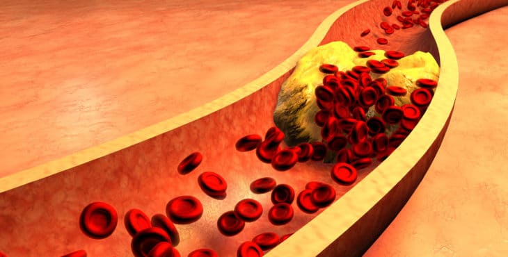 cómo reducir el colesterol