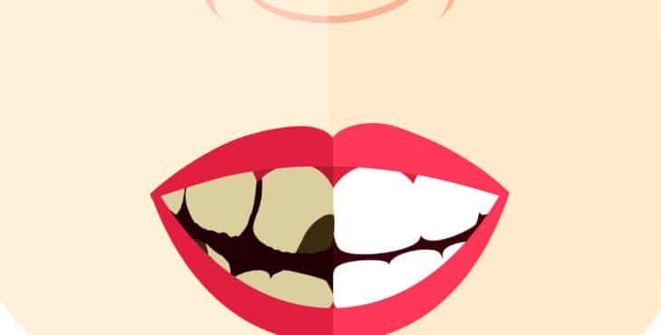 estética dental y sus claves