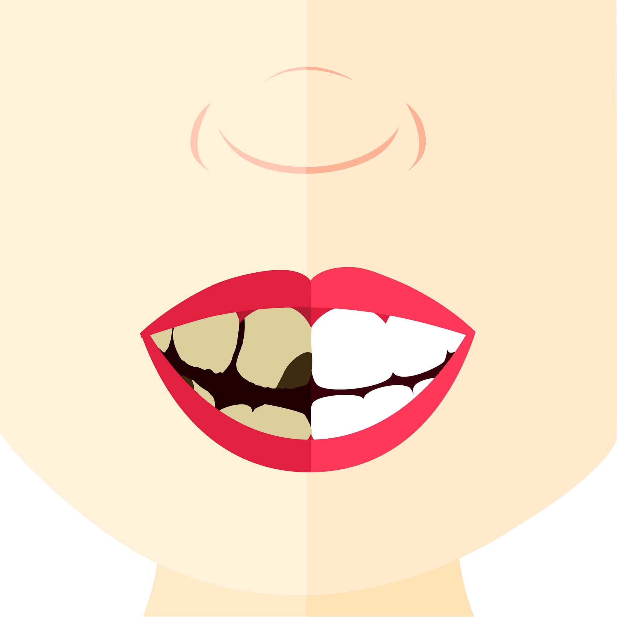 a estética dental y sus claves