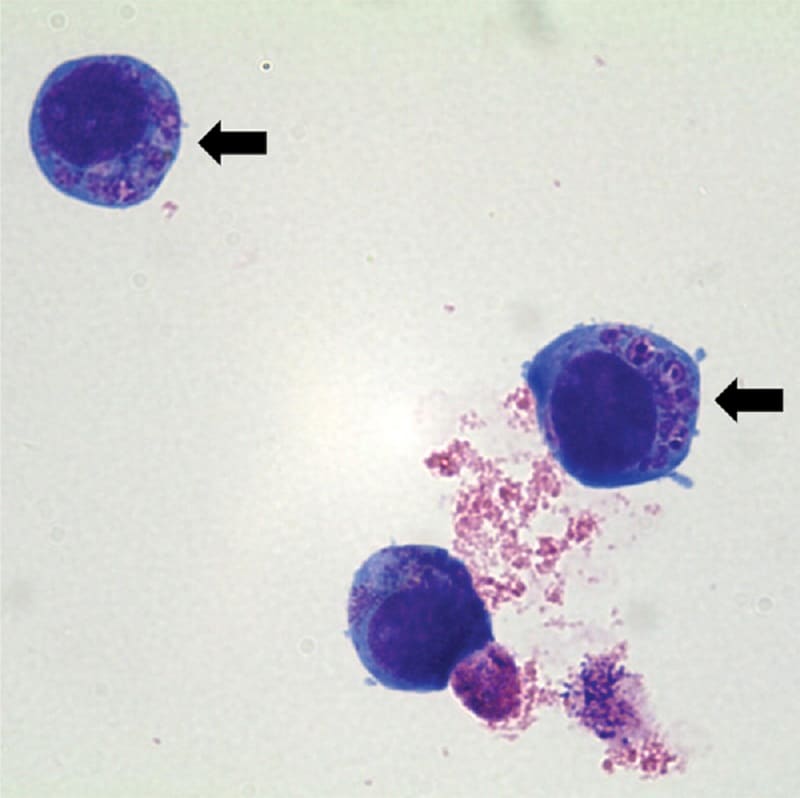 Anaplasma phagocytophilum
