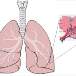4-Diagrama de pulmones y alveolos