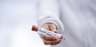 Vacunas contra el covid-19
